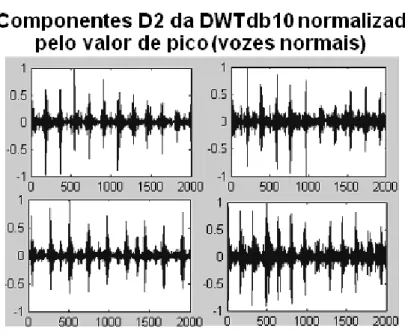 Figura 8 – Componentes de detalhe D 2 da DWTdb10 normalizados pelo valor de pico dos sinais de voz normal e patológica do banco de dados.