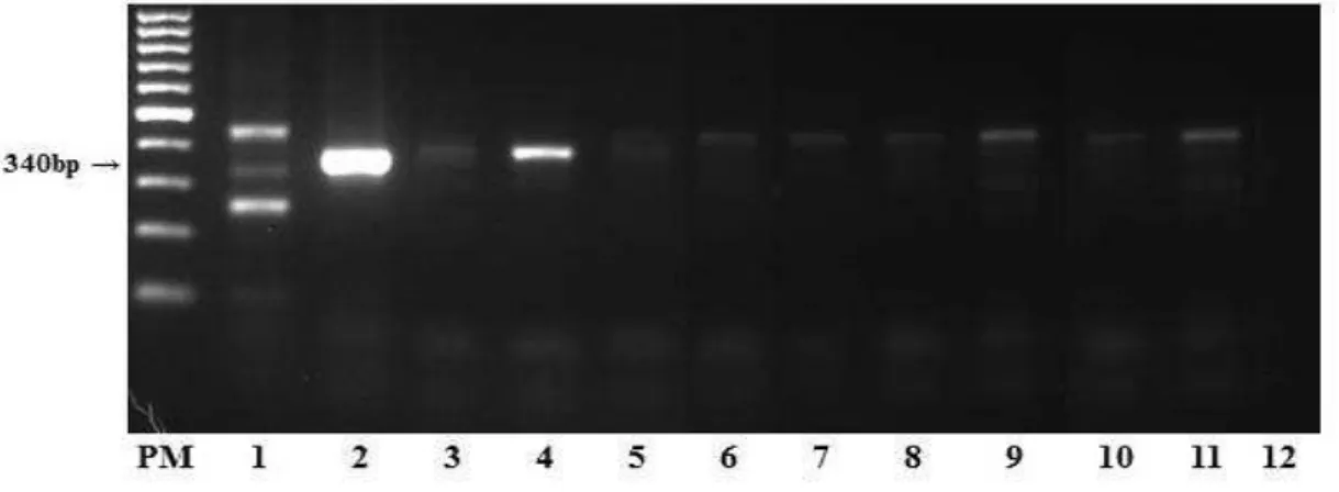 Figura 11- Amplificação de DNA, utilizando o primer gênero (340bp), a partir de amostra de  baço  de  animal  não  infectado  (1);  L3  de  S