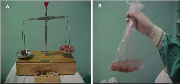 Figura 1 -  (A) Balança de dois pratos pesando os fragmentos prostáticos; (B)  Fragmentos prostáticos acondicionados em saco plástico com formol 