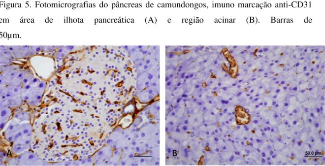 Figura  5.  Fotomicrografias  do  pâncreas  de  camundongos,  imuno  marcação  anti-CD31  em  área  de  ilhota  pancreática  (A)  e  região  acinar  (B)