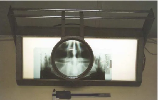 FIGURA 5 - Negatoscópio MB e paquímetro digital Mitutoyo 150 mm, utilizados para  mensuração das distâncias anatômicas, nas radiografias (grupo 1)