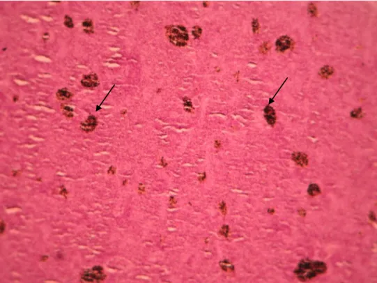 Figura 3.6 – Melanomacrófagos (seta) no baço Diplodus sargus (grupo infectado) 100x. 