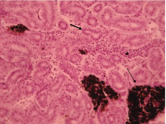 Figura  3.10  -  Melanomacrófagos  (seta  estreita),  túbulo  proximal  (seta  larga), células  inflamatórias  (*)  no  rim  de Diplodus sargus, grupo infectado (400x).