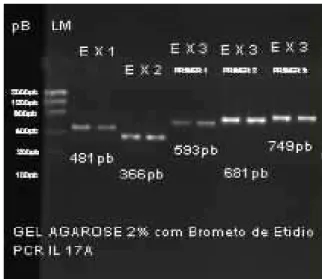Figura  3:  Foto  do  gel  de  Agarose  a  2%,  demonstrando  o  tamanho  dos  fragmentos  amplificados  pela  PCR  do  gene  da  IL-17A,  segundo  os  pares  de  oligonucleotídeos selecionados