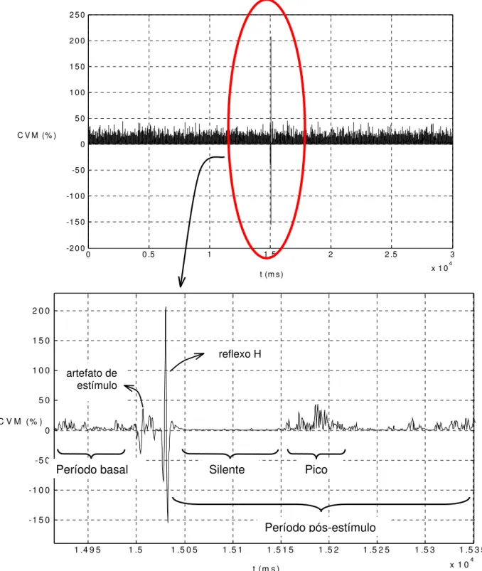 Figura 9. Gráfico de cima: EMG bruto do m. SO D, ajustado à linha de base, retificado (com  exceção do período que compreende o artefato do estímulo e o reflexo H) e normalizado pela CVM,  do sujeito 1, durante a condição SL