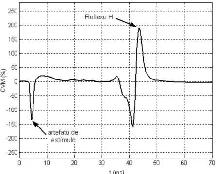 Figura 10. Artefato de estímulo, e reflexo H: média do sinal EMG bruto do m. SO D, ajustado  à linha de base e normalizado pela CVM, do sujeito 8, durante a condição SL