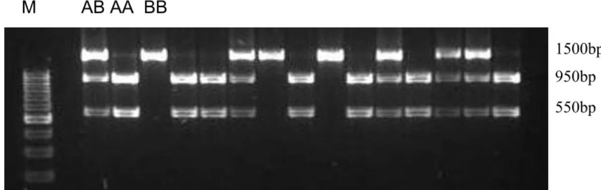 Figure 2 – Polimorfismo RFLP produzido pela enzima de restrição XmnI no gene  bovino  CAST