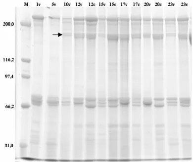 Figura  -7    Padrão  protéico  da  hemolinfa  de  fêmeas  de  Nezara  viridula  determinado  em  7,5% 