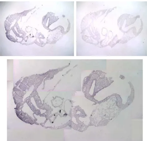 Figura 5:  Expressão de Hipk2  em embrião de 9.5dpc. Acima, à esquerda, a ampla  expressão de Hipk2  é observada no corte incubado com a sonda antisenso