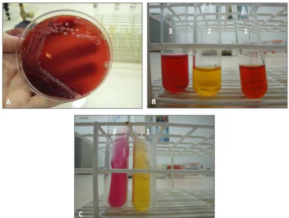 Figura 3 - Microbiológico das amostras de leite e dos fragmentos de glândula mamária  