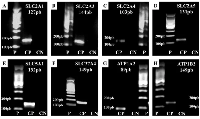 Figura 8- Eletroforese em géis de agarose para separação de produtos de PCR de genes que codificam as SLCs 