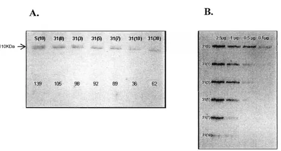Figura 11: Análise da expressão das proteínas APUM-l, APUM-2 e APUM-3 em extrato protéico de plantas antisenso induzíveis por dexametasona (31) comparadas com o extrato protéico da planta selvagem (S)