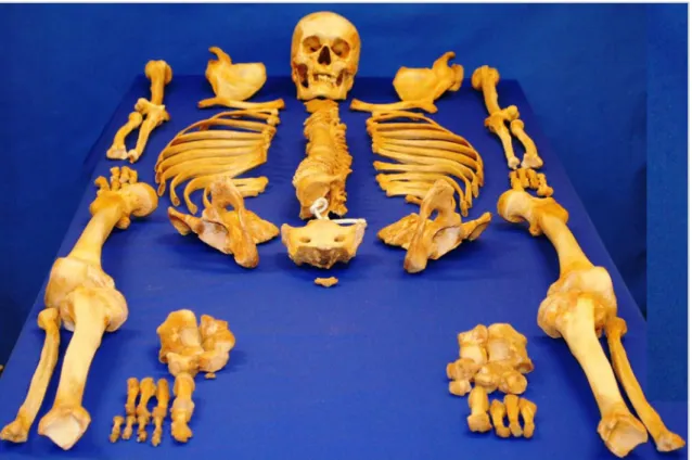 Figura 1 – Restos humanos totalmente esqueletizados. 
