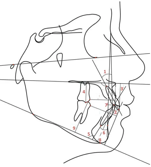 FIGURA 6: Grandezas cefalométricas dentárias superiores e inferiores 