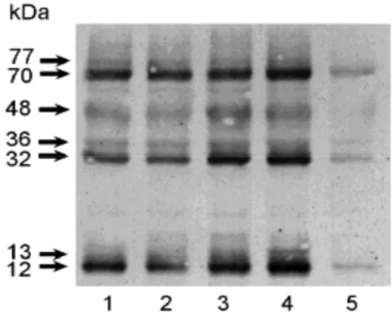 Figura 5. Western blot representativo da expressão de proteínas nitradas em resíduos de tirosina presentes  em homogenatos de pulmão de ratos alérgicos ou não e expostos à inalação com FA