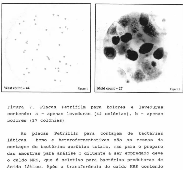 Figura 7. Placas Petrifilm para bolores e leveduras contendo: a - apenas leveduras (44 colônias), b - apenas bolores (27 colônias)