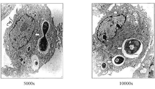 Figura 2: Microscopia eletrônica dos macrófagos ]774-16 após fagocitose das células leveduriformes de S