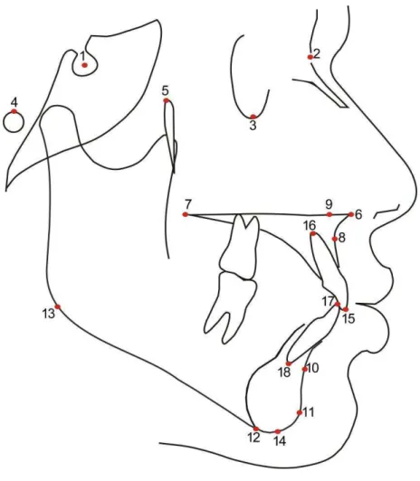 Figura 5.2- Pontos Cefalométricos 