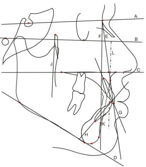 Figura 5.3 – Representação das linhas e planos. 