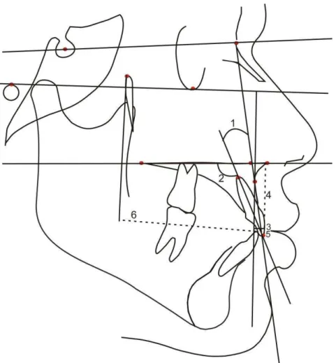 Figura 5.4 - Componente dentoalveolar anterior superior 