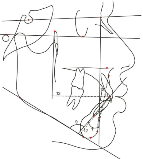 Figura 5.5 - Componente dentoalveolar anterior inferior 
