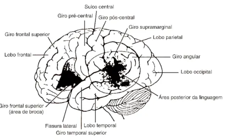 Figura 1 – Vista lateral do cérebro mostrando os principais centros da fala e da  linguagem