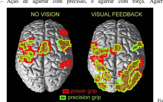 Fig.  1 25   Brain  activity during precision gripping (green) and power gripping (red), superimposed on a normalized  template brain