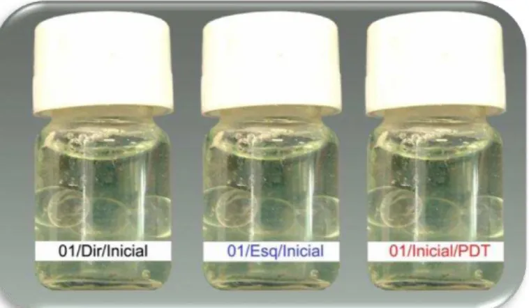 Figura 4.10 - Tubos de VMGA III identificado com etiqueta adesiva, com número do paciente, lado e                      momento da coleta, respectivamente 