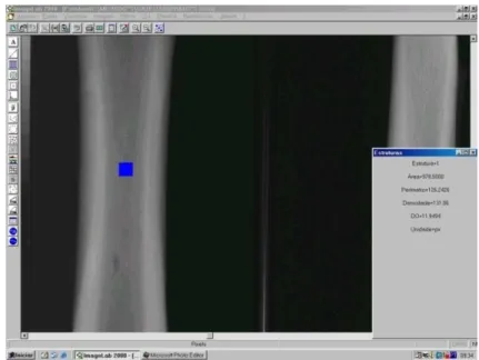 Figura 11 -  Visualização do programa ImageLab ®  mostrando a leitura da densidade  óptica (DO) do quadrilátero correspondente à região média do osso  terceiro metacarpiano na projeção dorso-palmar 