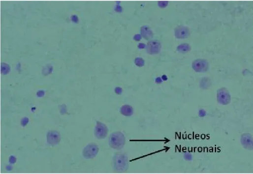 Figura 3. Núcleos neuronais de tecido cortical. Núcleos grandes com nucléolo  evidente