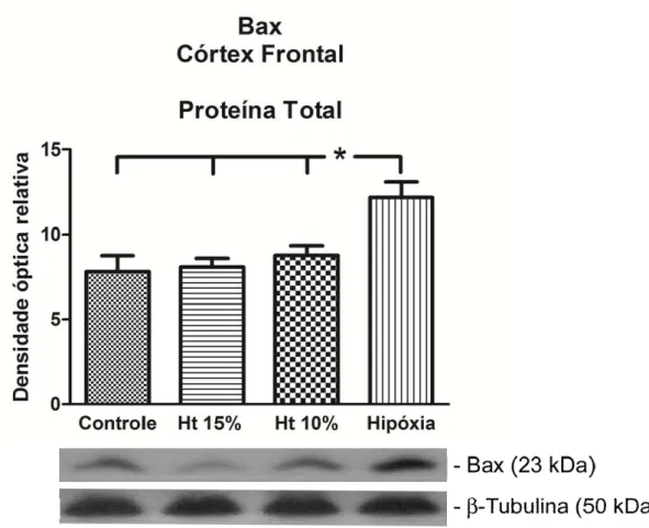 Figura 5. Western blot representativo da expressão de proteína pró-apoptótica Bax  no extrato de proteína total do córtex frontal nos grupos controle, Ht 15%, Ht 10% e  hipóxia-hipóxica