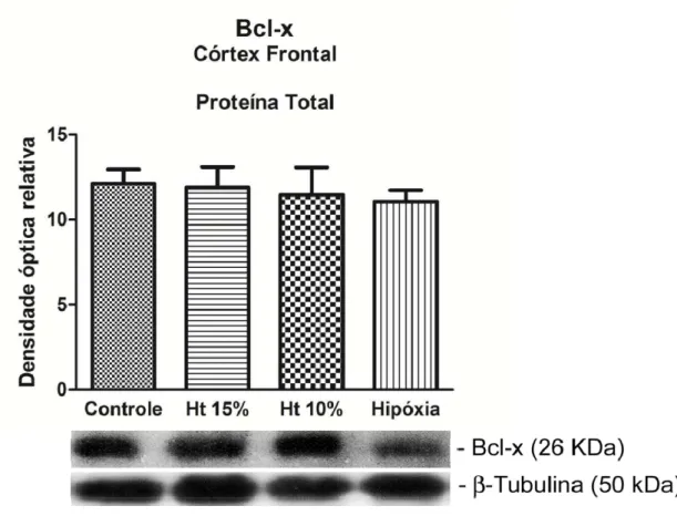 Figura 8. Western blot representativo da expressão de proteína anti-apoptótica Bcl- Bcl-x no eBcl-xtrato de proteína total do córteBcl-x frontal nos grupos controle, Ht 15%, Ht 10% 