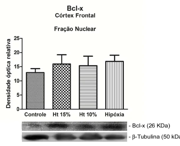 Figura 10. Western blot representativo da expressão de proteína anti-apoptótica  Bcl-x na fração nuclear de córtex frontal nos grupos controle, Ht 15%, Ht 10% e  hipóxia-hipóxica