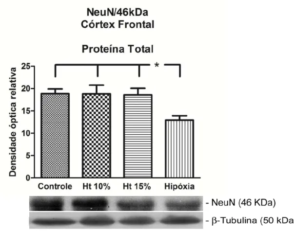 Figura 11. Western blot representativo da expressão de NeuN 46 kDa no extrato de  proteína total de córtex frontal nos grupos controle, Ht 10%, Ht 15% e  hipóxia-hipóxica