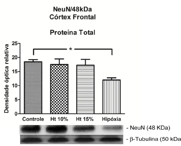 Figura 12. Western blot representativo da expressão de NeuN 48 kDa no extrato de  proteína total de córtex frontal nos grupos controle, Ht 15%,Ht 10% e  hipóxia-hipóxica