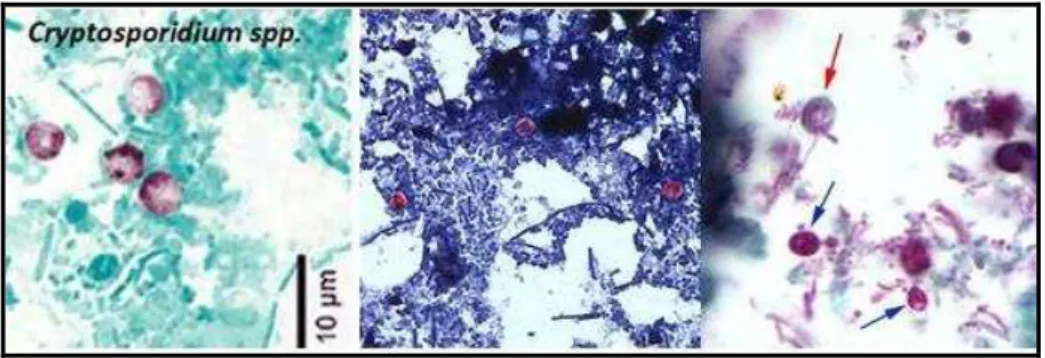 Figura 3- Oocistos de Cryptosporidium spp. corados por diferentes  técnicas. 