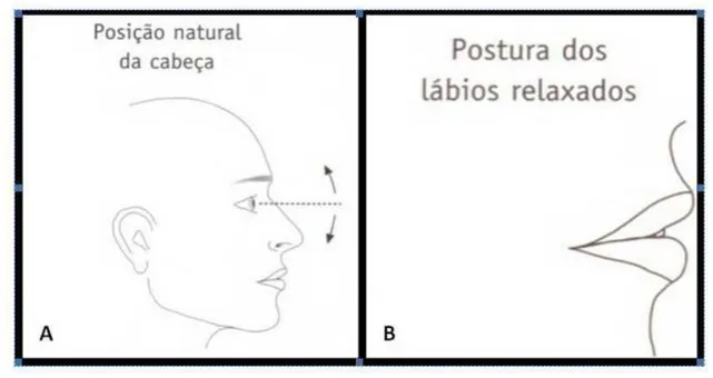 Figura 3: Esquema ilustrativo da posição natural da cabeça. B: Lábios relaxados. IN: (ARNETT, G.; 