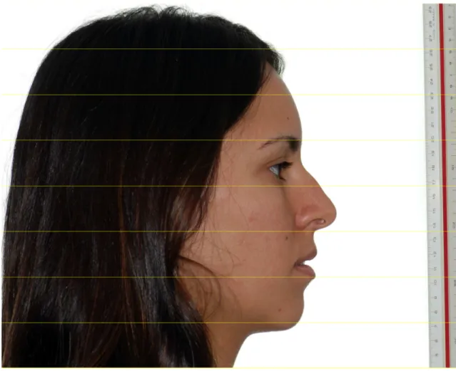 Figura 5: Fotografia de perfil em repouso mostrando a régua milimetrada utilizada para calibração da  imagem