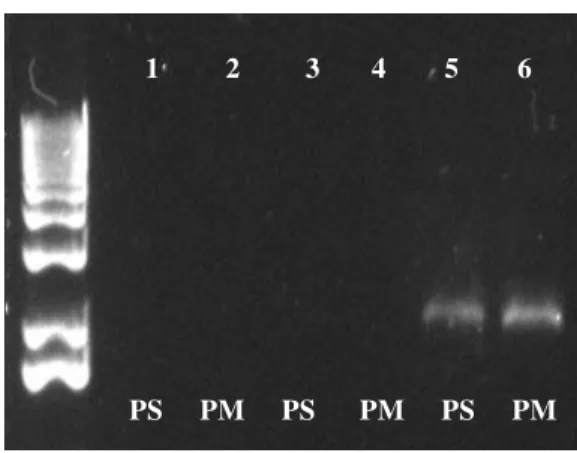 Figura 2- RT-PCR para a detecção do gene da proteína capsidial das estirpes fraca e severa do PRSV-W  com os primers específicos da estirpe severa (PS) e da estirpe fraca (PM)