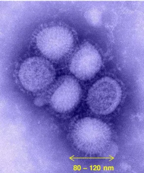 Figura 1. Micrografia do vírus influenza tipo A/H1N1, indicando o tamanho da partícula viral entre 80  nm  e 120 nm