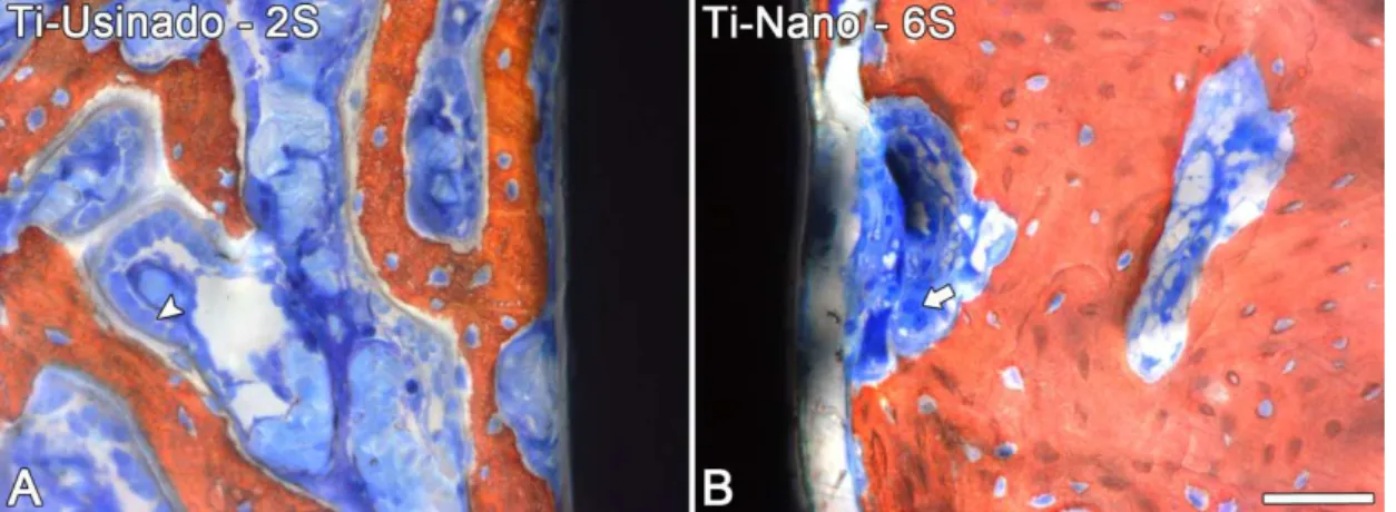 Figura 7. Secções mésio-distais dos implantes Ti-Usinado (A) e Ti-Nano (B) após  duas e seis semanas de implantação, respectivamente
