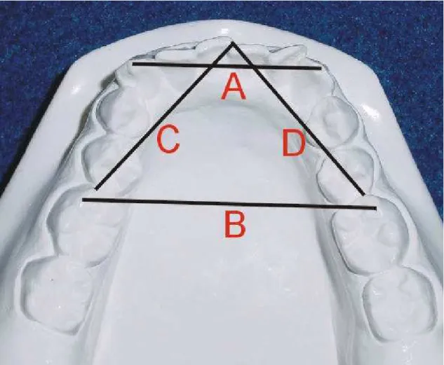 Figura 4.1: Variáveis estudadas na análise de modelos: A- distância  intercaninos, B- distância intermolares, C+D- comprimento do arco