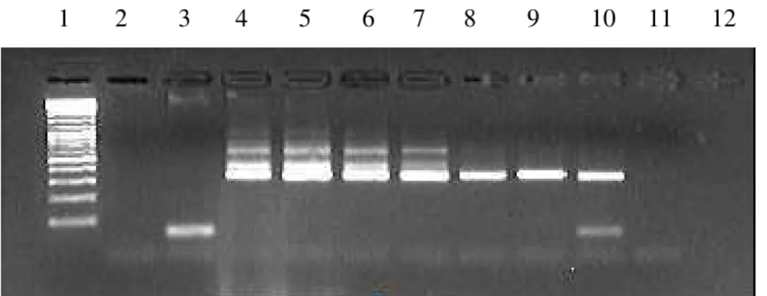 Figura  1  -  Ensaio  de  PCR  analítico,  utilizando  diluições  seriadas  de  DNA  de  epimastigota  extraído  de  cepa  Y,  considerando  a  massa  de  DNA