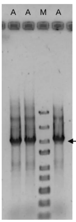 Figura 7 | PCR I+II com baixo rendimento. A  seta indica a banda de 2 kb do marcador de  massa molecular