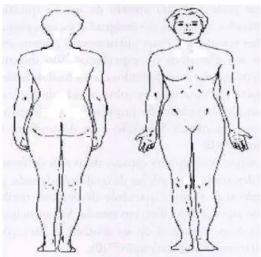 Figura 8  - Diagrama de dor no corpo.. A avaliada deveria assinalar na figura o  (s) local (is) de dor (es) no seu corpo