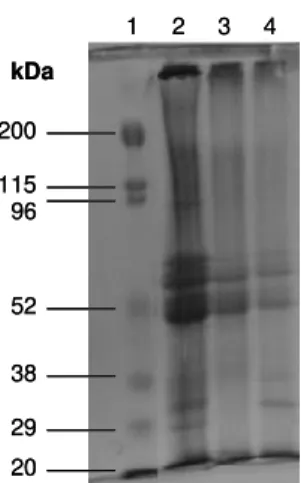 Figura  5.1.  Gel  de  Eletroforese  10 %  SDS-PAGE.  1 o   perfil:  Padrão  de  peso  molecular;                      