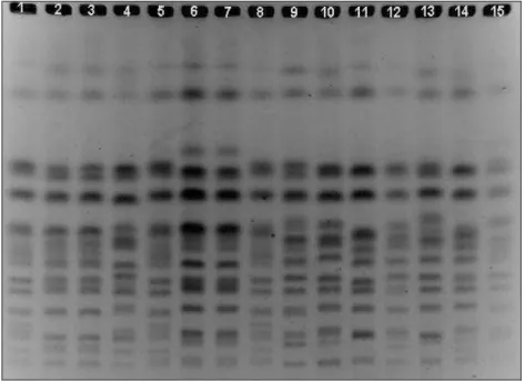 Figura 7 – Cariotipagem eletroforética de 15 colônias tomadas ao acaso da amostra D(3)