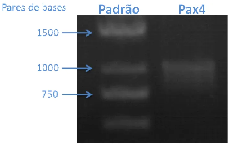 Fig 1: Amplificação do cDNA correspondente ao gene Pax4 de aproximadamente 1 Kpb, a partir da  biblioteca de cDNA de INS-1E, sendo possível observar a presença de uma única banda