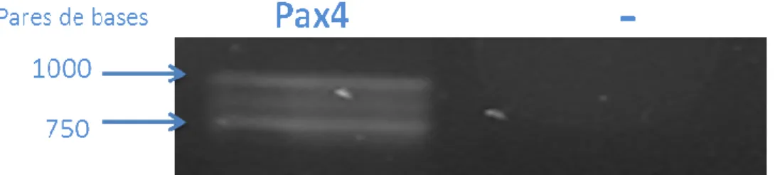 Fig 2: Amplificação do cDNA correspondente ao gene Pax4 a partir de células RINm5f. Observa-se a  presença de três isoformas do transcrito