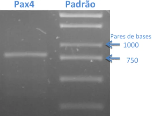 Fig 7: Eletroforese em gel de agarose do produto da amplificação do gene Pax4 por RT-PCR a partir de  cDNA obtido de células 293T transfectadas transitoriamente com a construção pVP22.Pax4